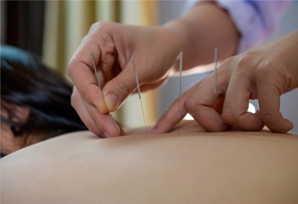 Acupuncture Therapy Whitby