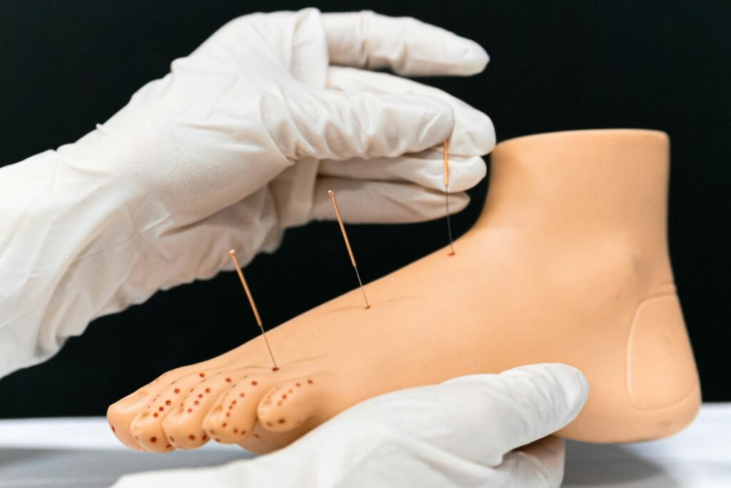 Dry Needling Whitby